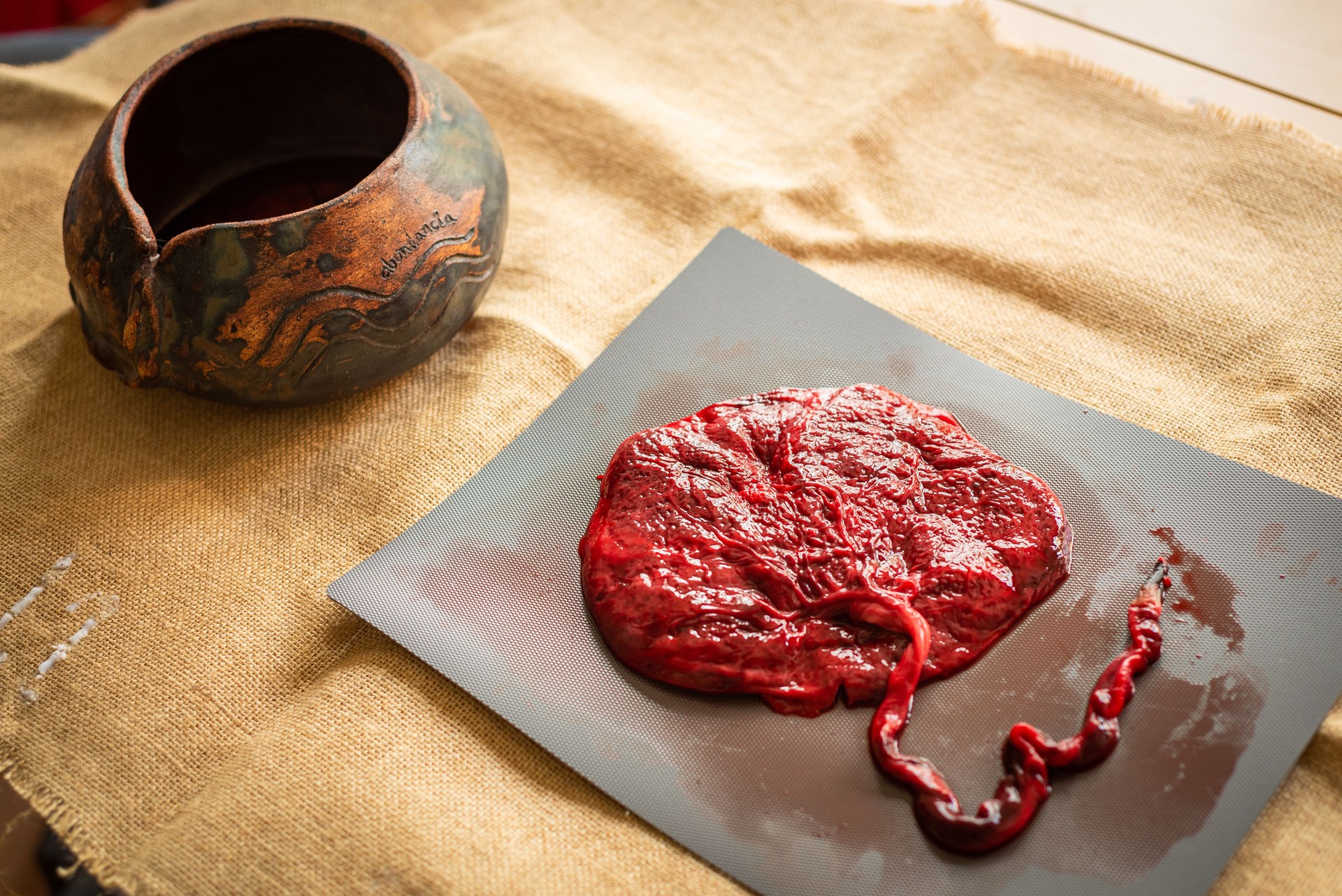 Placenta and umbilical cord of newborn baby with a ritual pot are seen in close up. A fresh real human placenta with blood is seen close up on table after childbirth